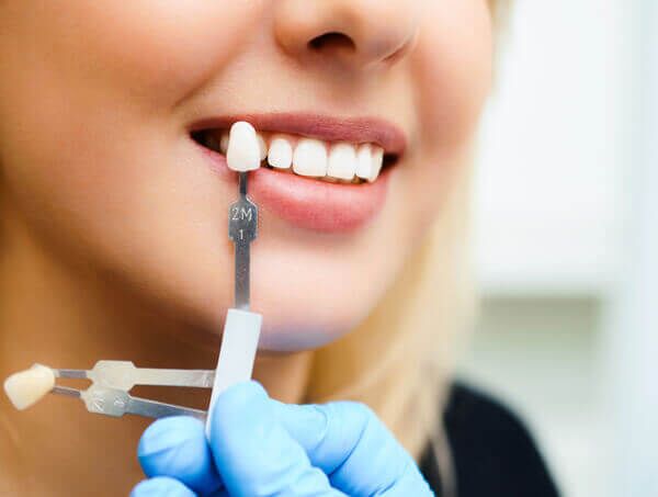 Teeth Whitening in Wimbledon
